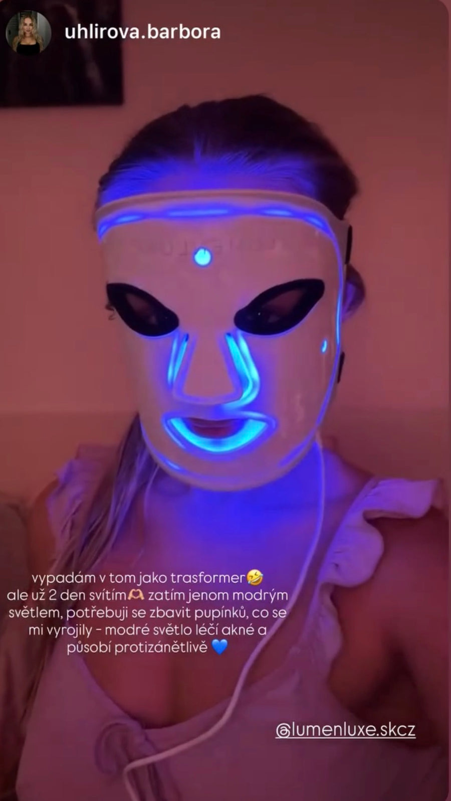 LumenLuxe LED arcmaszk – vásárlói fotó